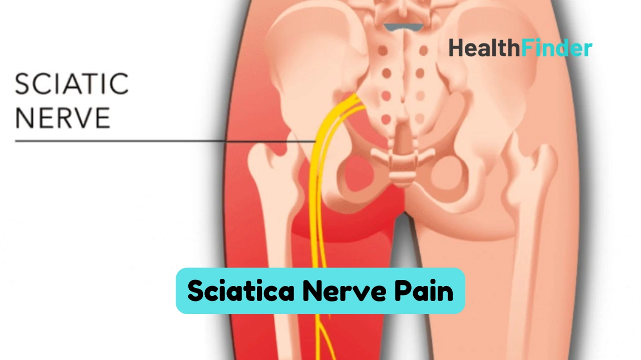 Sciatica Nerve Pain