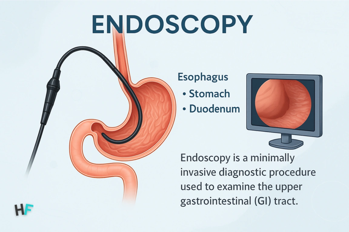 What is Endoscopy