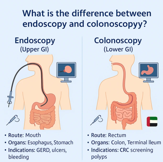 What is the difference between endoscopy and colonoscopy