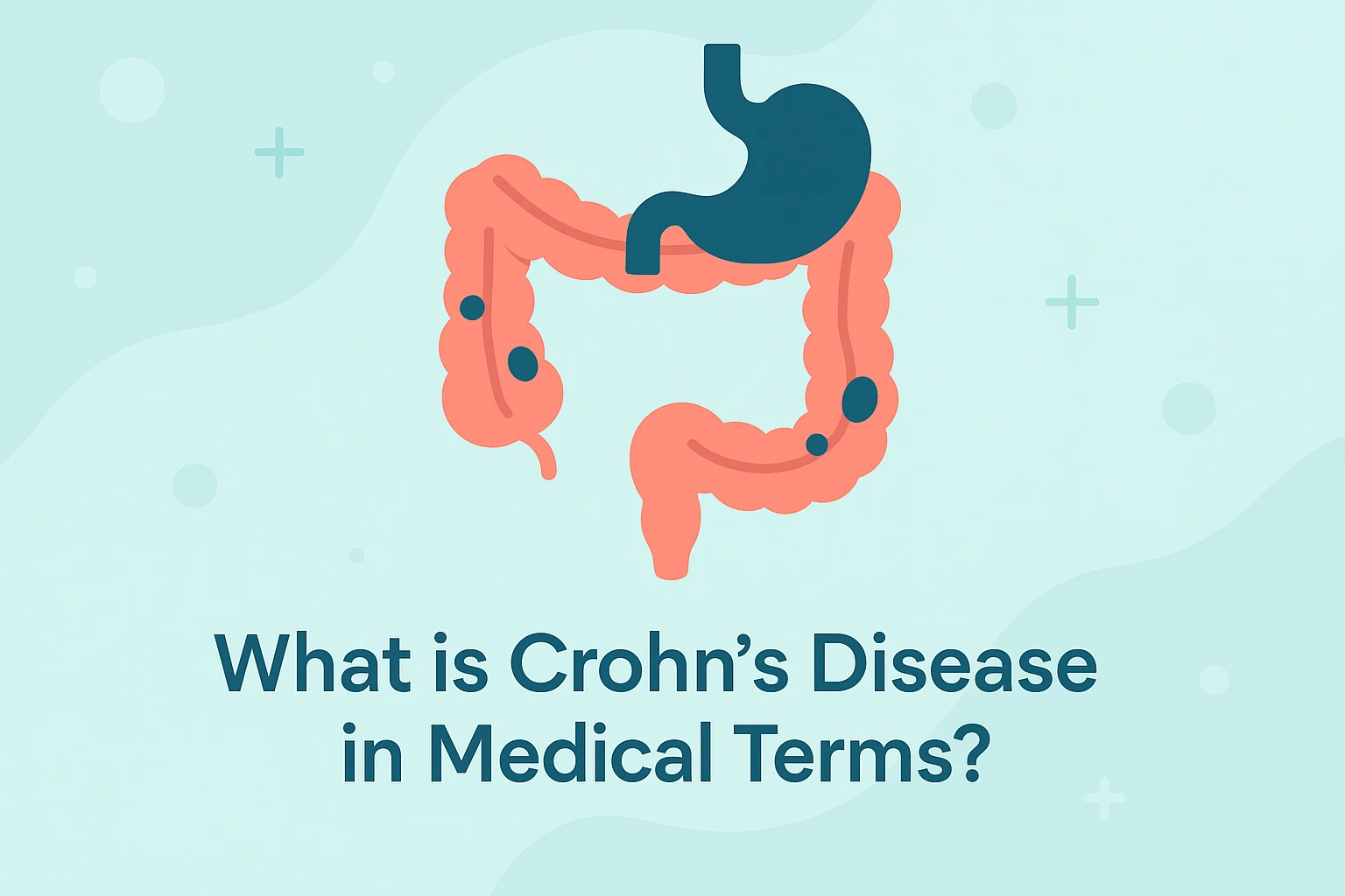 crohns-disease