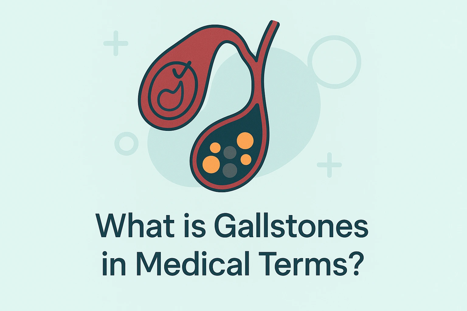 gallstones