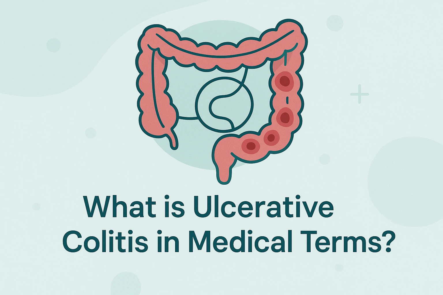 ulcerative-colitis