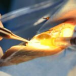 Dr Mustafa Abu Dhabi – Cataract Surgery & Vision Care Expert