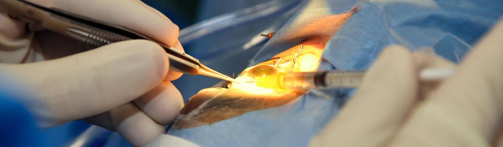 Dr Mustafa Abu Dhabi – Cataract Surgery & Vision Care Expert