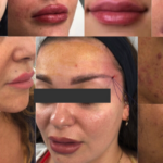 Dermatologist Dr. Omnia Khater