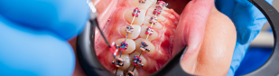 How Do I Know If My Orthodontist Is Bad?
