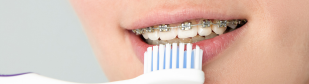 How To Wash Your Teeth With Braces?