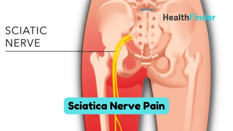 Sciatica: Causes, Symptoms & Effective Pain Relief Tips