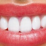 Al Najma Dental Clinic