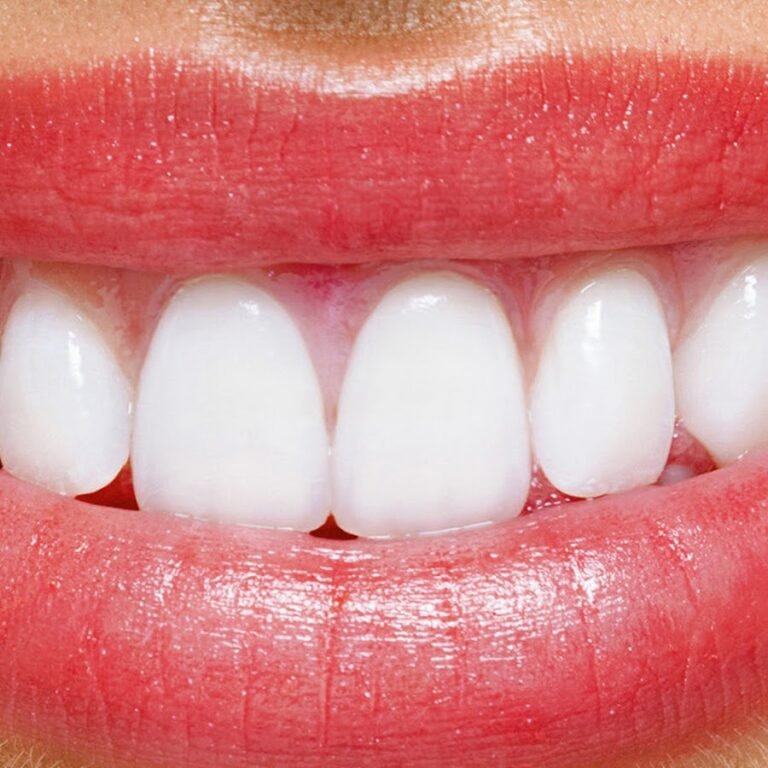 Al Najma Dental Clinic