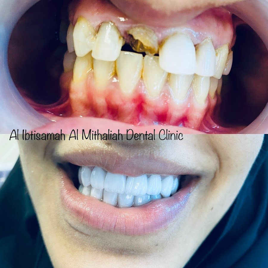 Alibtisamah almithaliah dental clinic