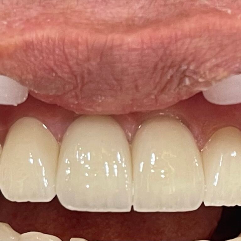 CORAL Dental Clinic – Dentist in Abu Dhabi, Al Aamerah