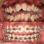 Dr Karan Kalra – Invisalign specialist/Orthodontist- Reem Island