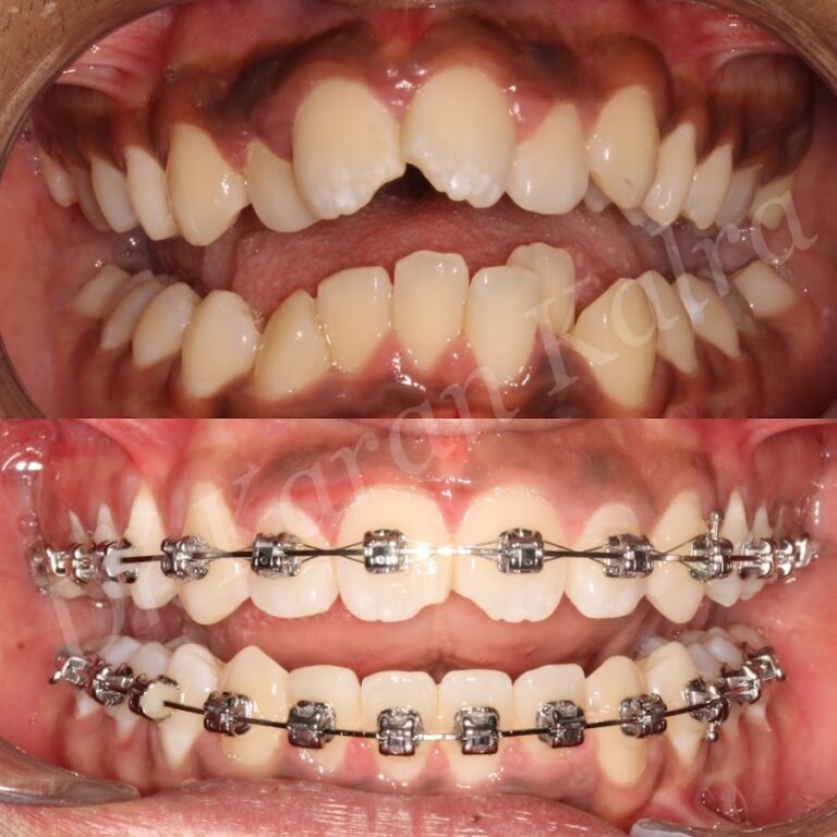 Dr Karan Kalra – Invisalign specialist/Orthodontist- Reem Island