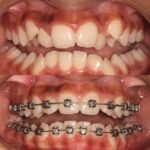 Dr Karan Kalra- Orthodontist (braces Specialist)