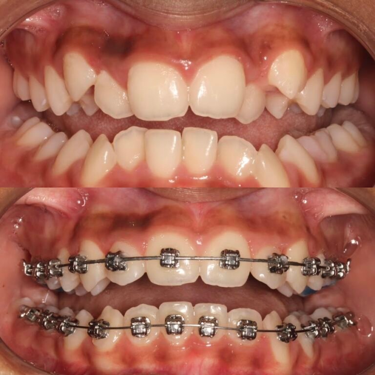 Dr Karan Kalra- Orthodontist (braces Specialist)
