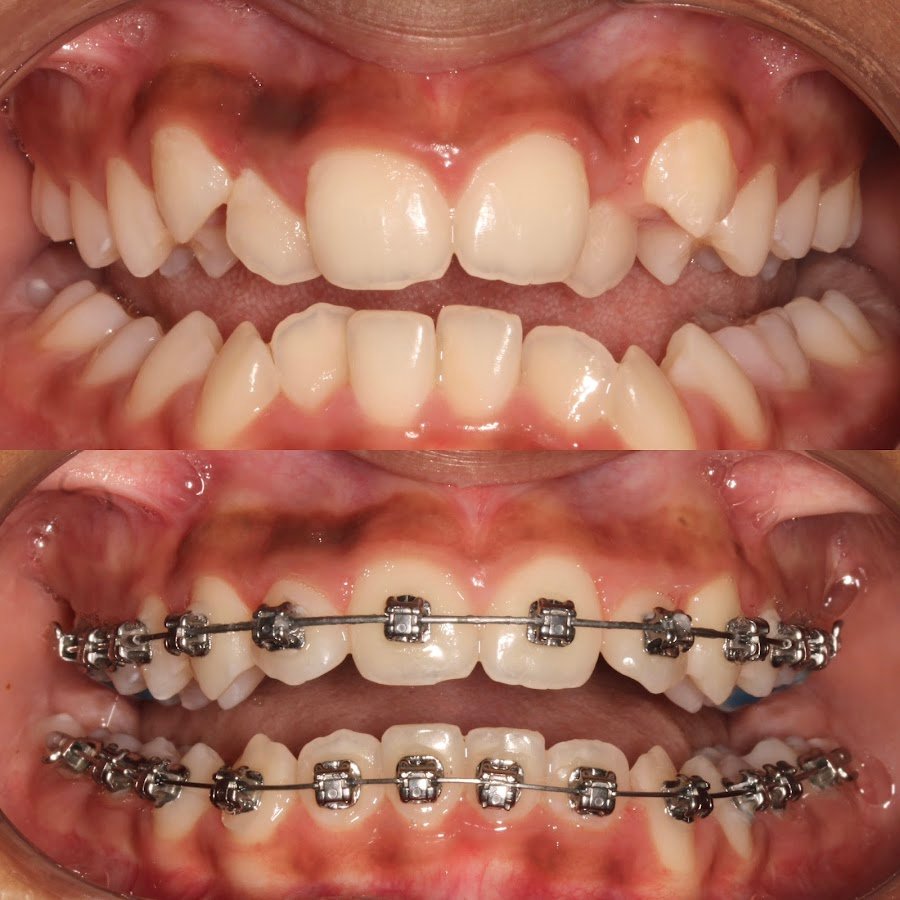 Dr Karan Kalra- Orthodontist (braces Specialist)