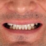 Dr. Kinan Bonni, Best Veneers Dentist in UAE