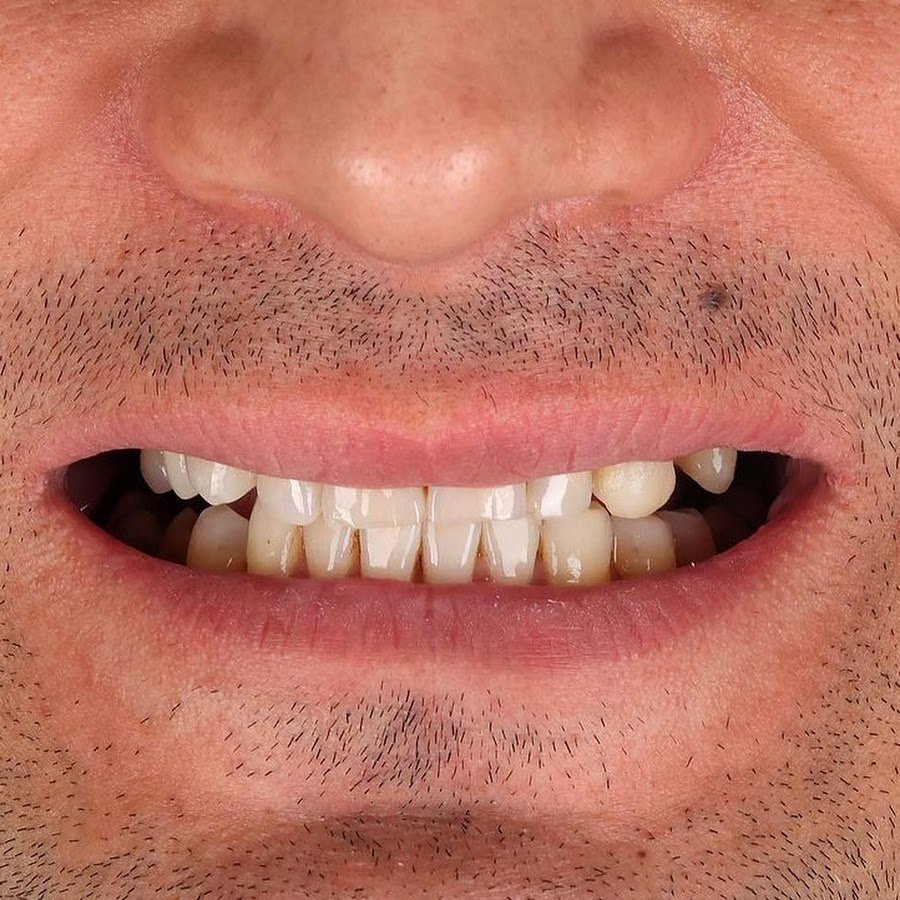 Dr. Kinan Bonni, Best Veneers Dentist in UAE