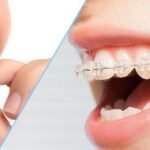 Dr. Mohamed Saif Eldawla – Leading Orthodontist & Invisalign Specialist in Dubai