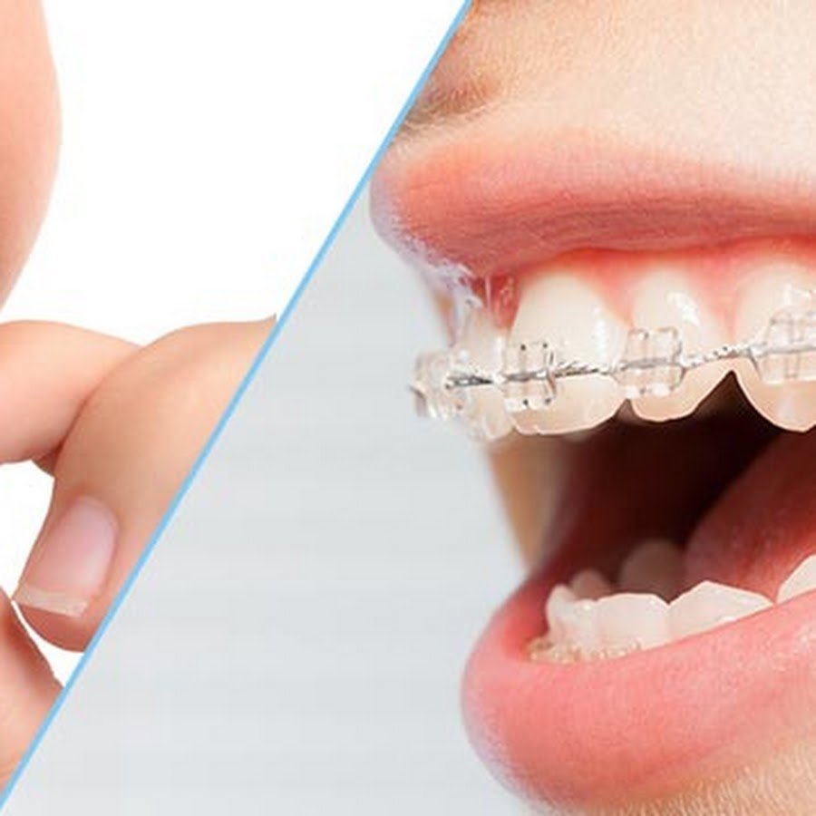 Dr. Mohamed Saif Eldawla – Leading Orthodontist & Invisalign Specialist in Dubai