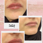 Dr Mohanad Almalekh – Dermatologist in Al Ain