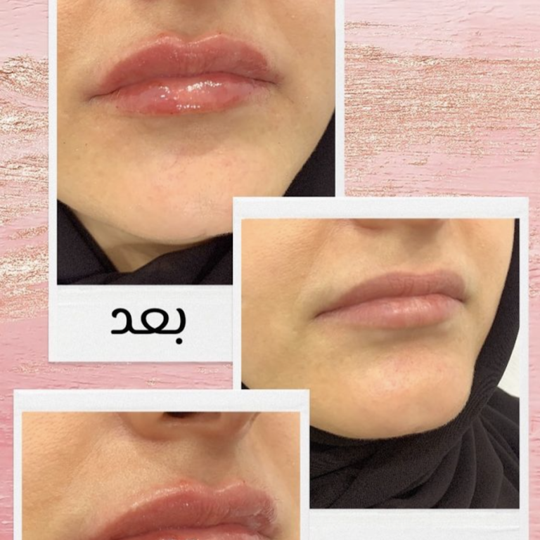 Dr Mohanad Almalekh – Dermatologist in Al Ain