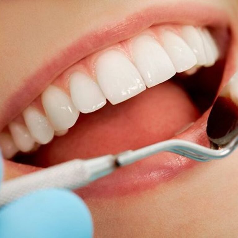 Dr Niketa – Periodontist and Implantologist – Smile Story Dental Clinic