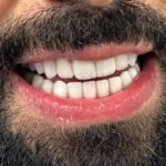 Dr Nour Nasser – Cosmetic Dentist