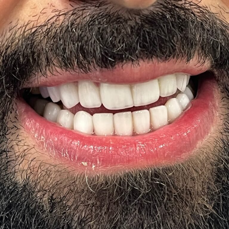 Dr Nour Nasser – Cosmetic Dentist