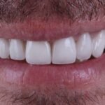 Dr. Omar Aldaoudi – Specialist Prosthodontist