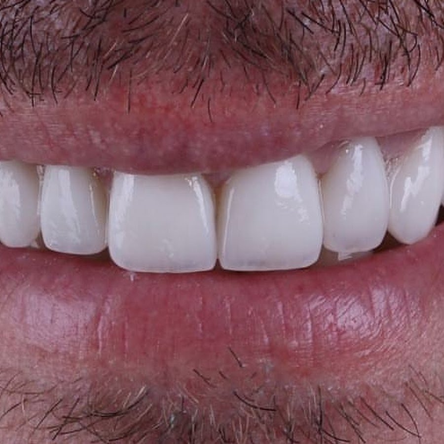 Dr. Omar Aldaoudi – Specialist Prosthodontist