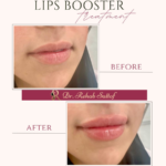 Dr. Rehab/ Dermatologist