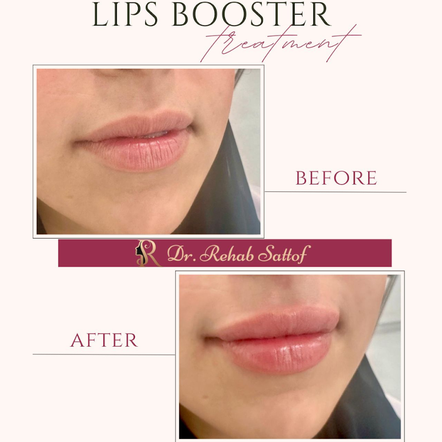 Dr. Rehab/ Dermatologist