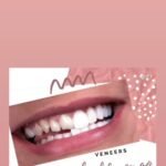 Dr Rumisa Nabi – Dentist Implantologist