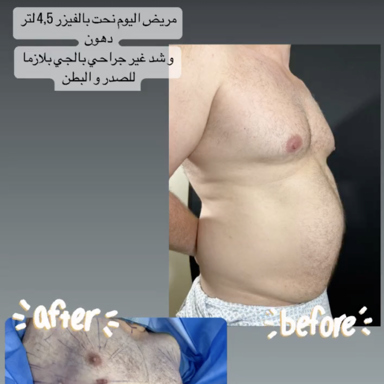 Dr. Saba Al Marush – Female Plastic Surgeon in Al Ain | Liposuction | Body Contouring | Breast Augmentation | BBL