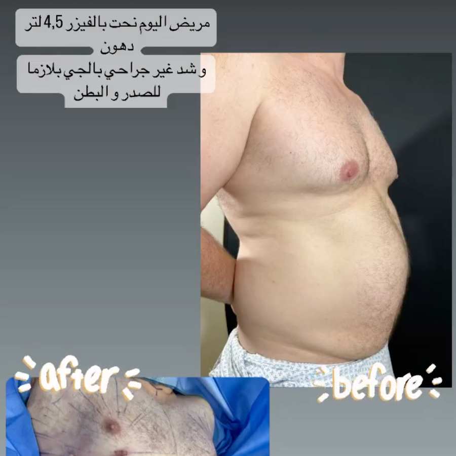 Dr. Saba Al Marush – Female Plastic Surgeon in Abu Dhabi | Liposuction | Body Contouring | Breast Augmentation | BBL