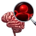 Dr. Sathish Kandasamy | Best Interventional Radiologist Dubai | Fibroid, Prostate, Thyroid, Vein & Vascular Treatment UAE