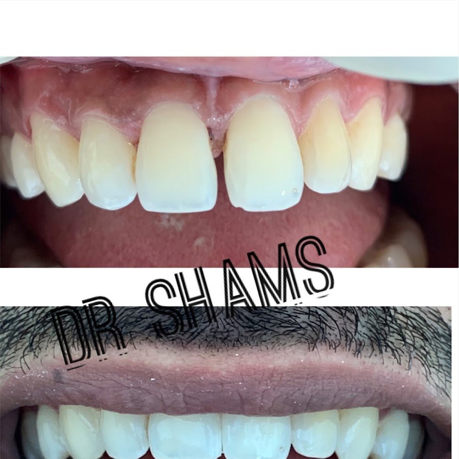 Dr. Shams Tabrez – B.D.S, M.D.S. (Orthodontics), C-ICOI-(Implantology)