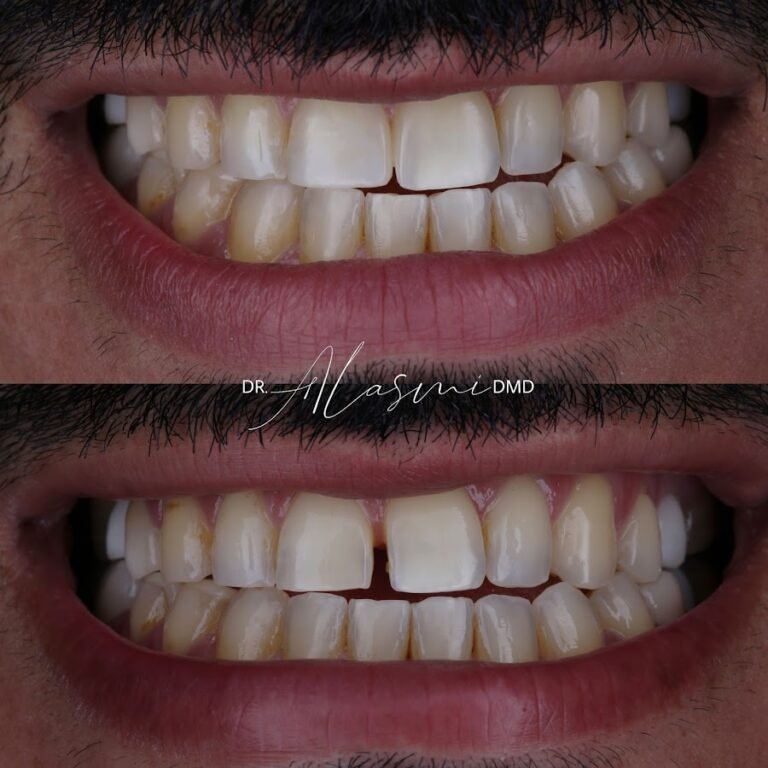 Dr.Tarek Alasmi