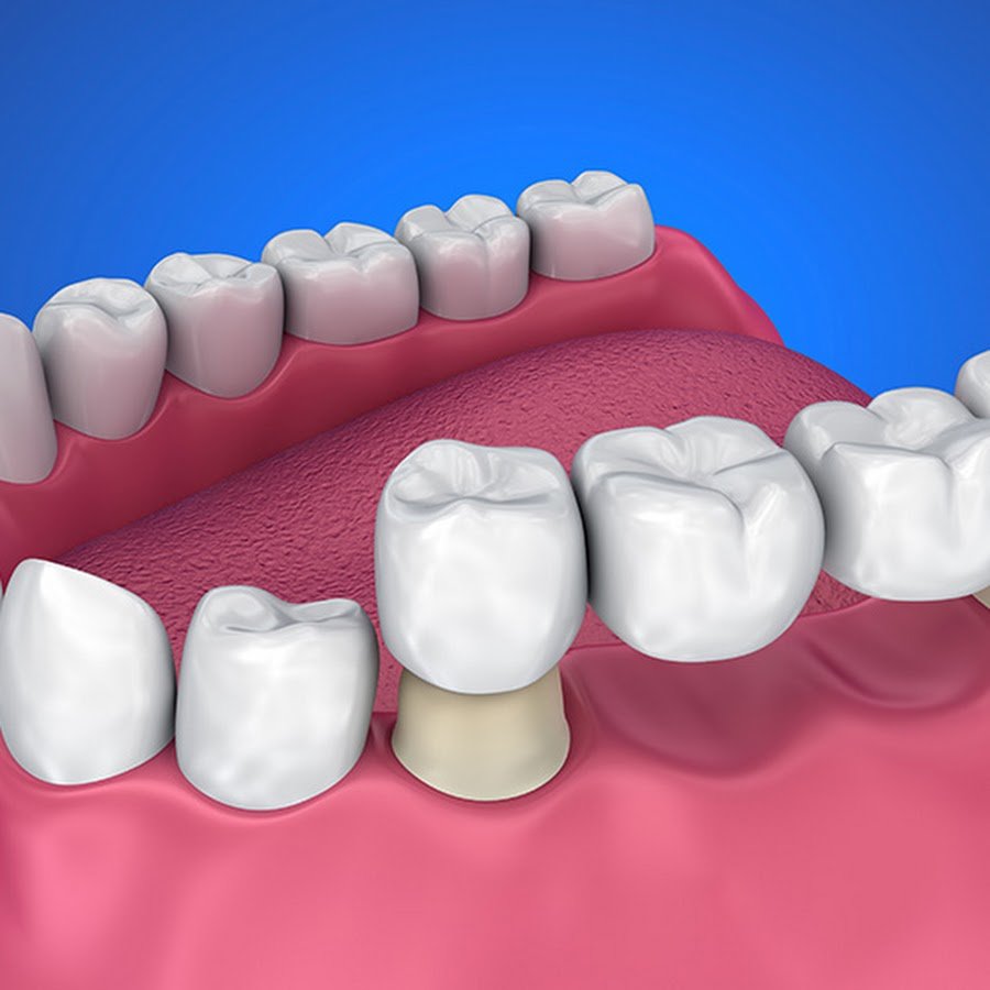 Dr. Thomas Dental Implant Clinic