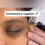 Glamorous Aesthetic Clinic Dubai – Rhinoplasty, BBL, Liposuction, Gynecomastia, Tummy Tuck, Breast Implants, Fillers, Botox