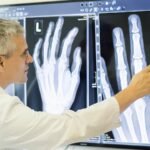 Hand Surgeon Dubai | Prof. Dr. Robert Hierner