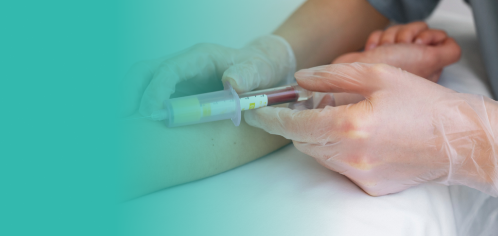 Confidential HIV Test in Dubai – Fast & Trusted Screening