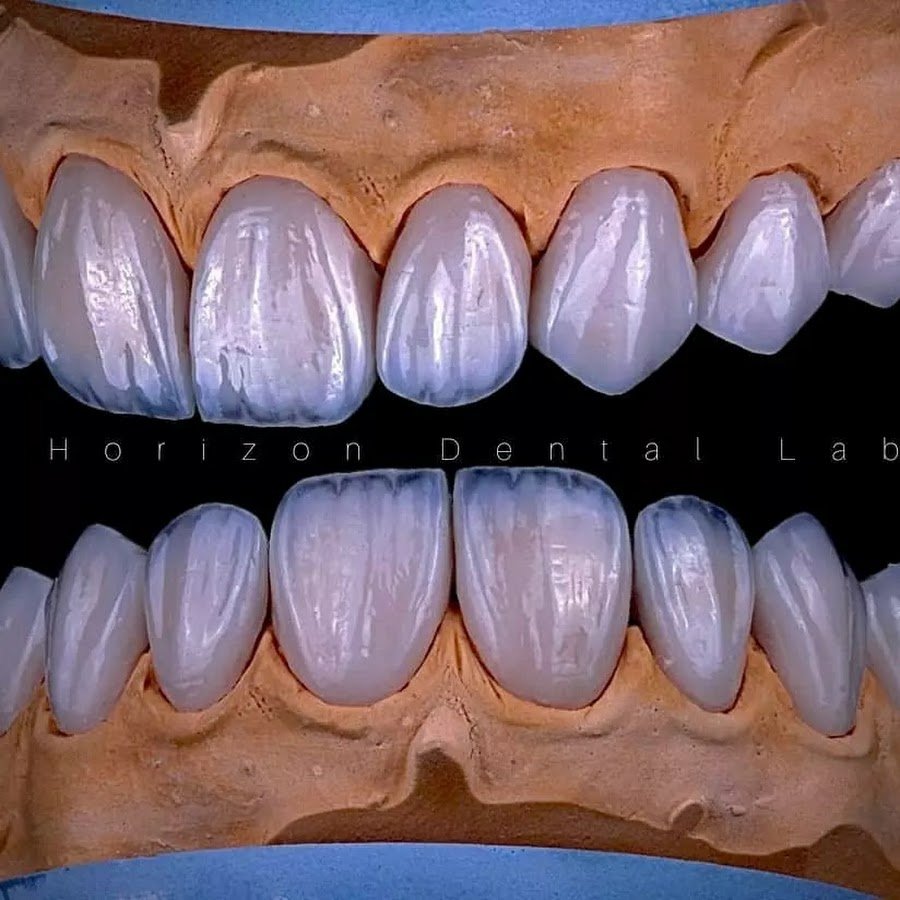 Horizon Dental Lab