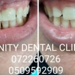 Infinity Dental Clinic – Dentist in Ras Al Khaimah on Al Khor Road, RAK