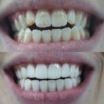 MUNICH DENTAL CLINIC Dubai