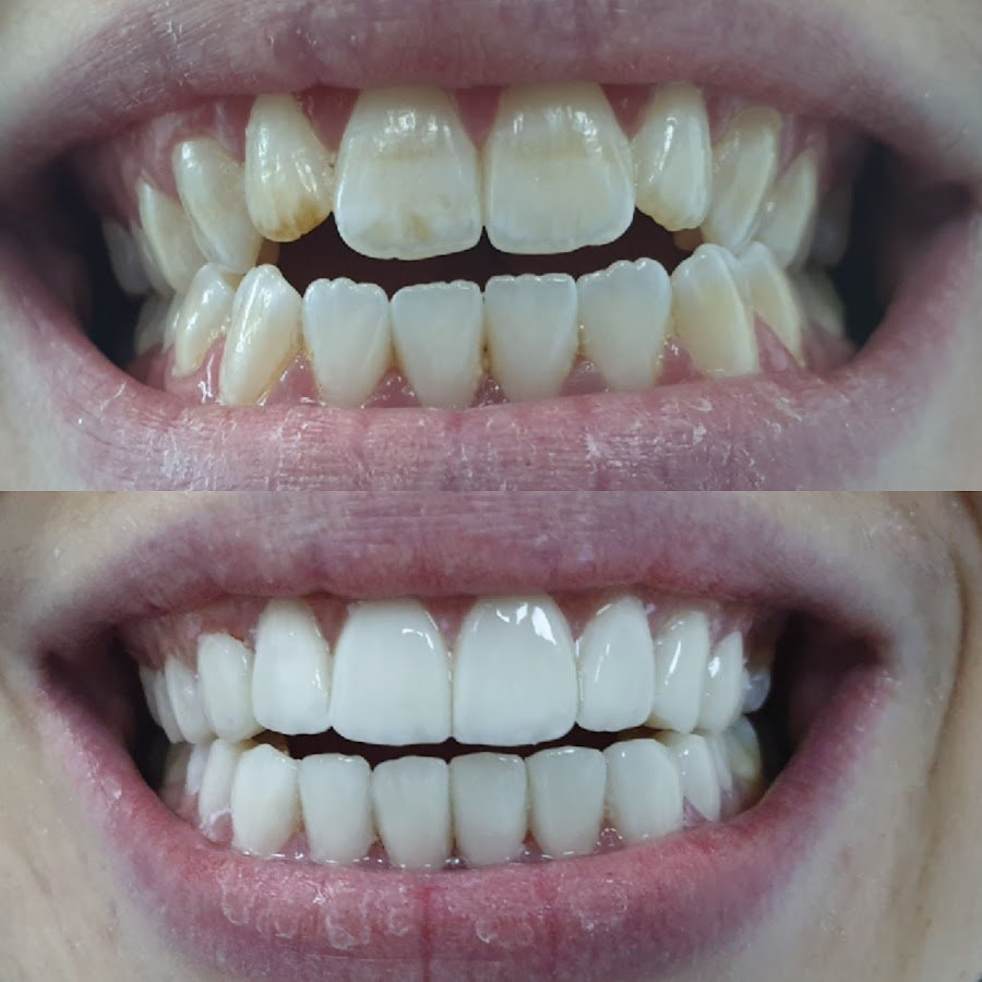 MUNICH DENTAL CLINIC Dubai