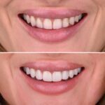 MyoSmile Polyclinic – Dental Clinic in Jumeirah