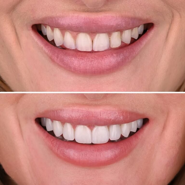 MyoSmile Polyclinic – Dental Clinic in Jumeirah